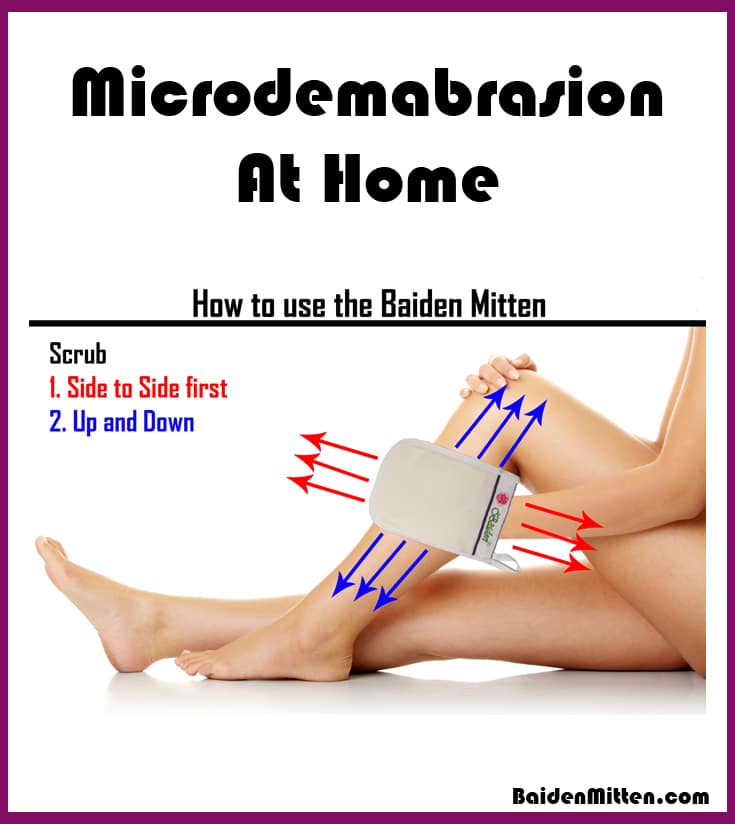 microdermabrasion at home