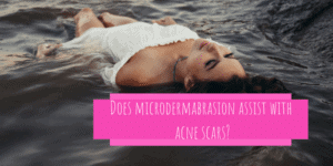 Does Microdermabration Assist in removing acne scars - Baiden Mitten