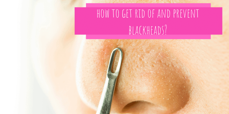 How to get rid of and prevent blackheads